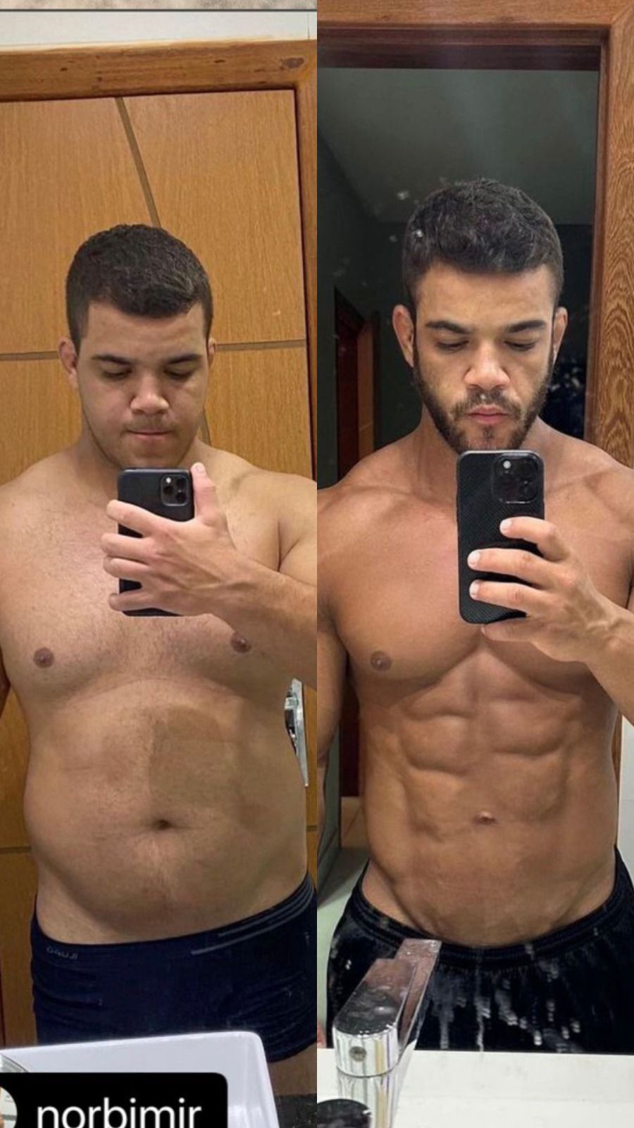 Recomposição corporal extrema